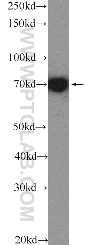 Western Blot (WB) analysis of HeLa cells using MSN Polyclonal antibody (26053-1-AP)
