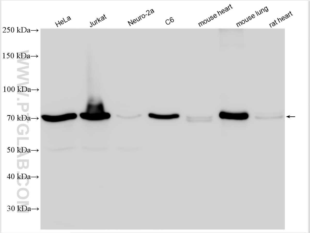 Western Blot (WB) analysis of various lysates using MSN Polyclonal antibody (26053-1-AP)