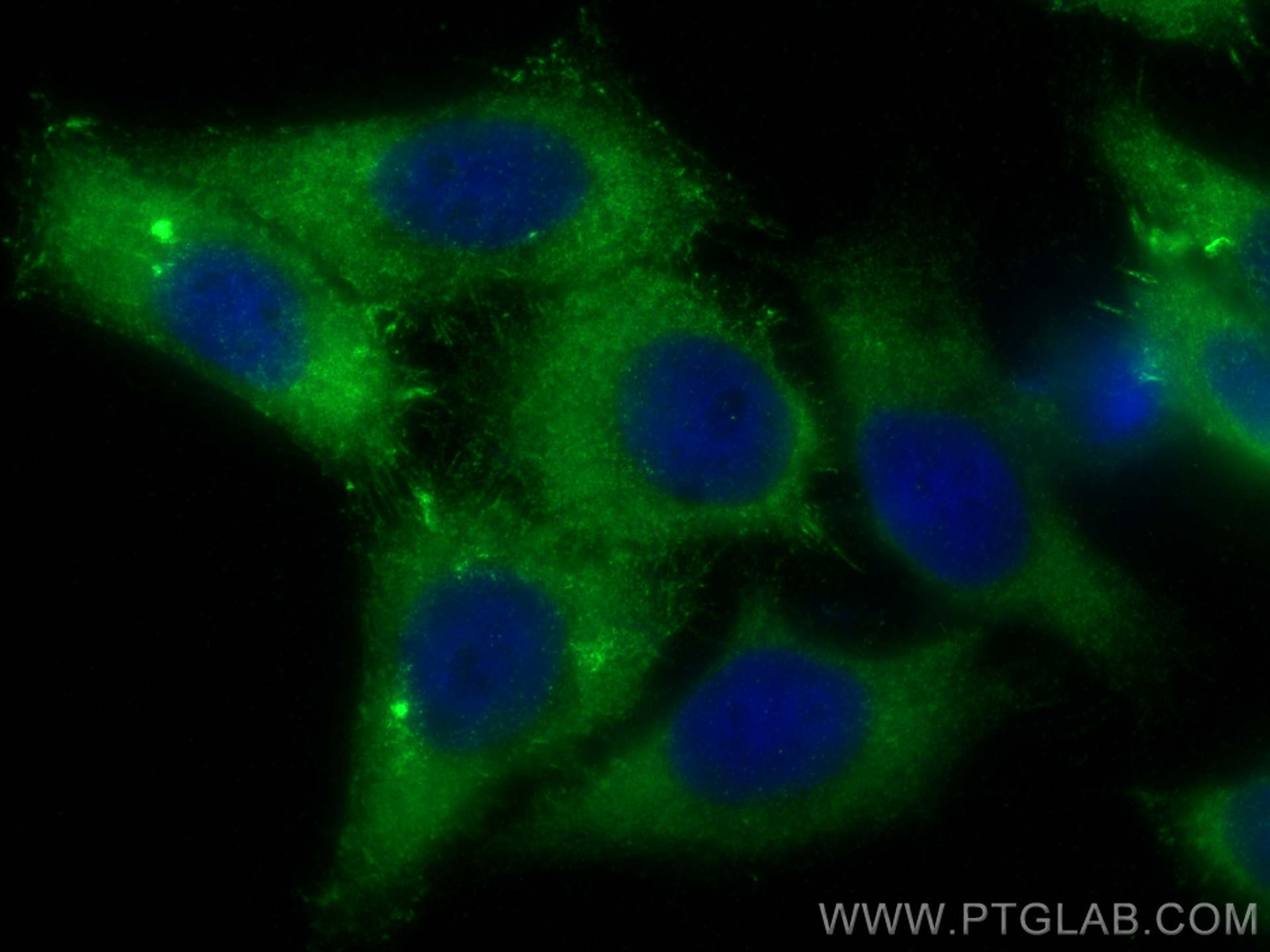 Immunofluorescence (IF) / fluorescent staining of HepG2 cells using Moesin Recombinant antibody (82009-1-RR)