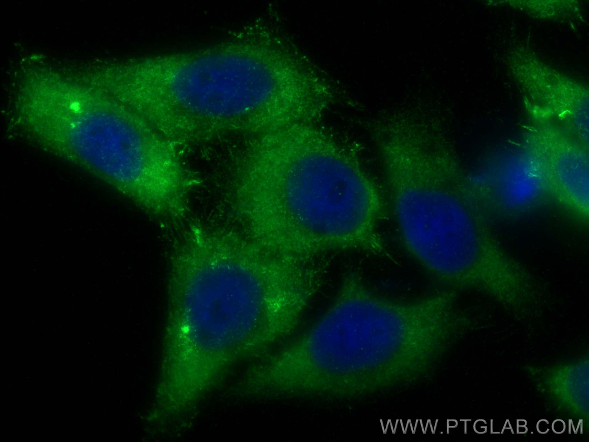 IF Staining of HepG2 using 82009-1-RR