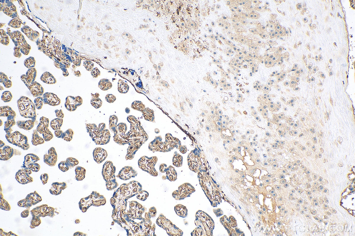 Immunohistochemistry (IHC) staining of human placenta tissue using Moesin Recombinant antibody (82009-1-RR)