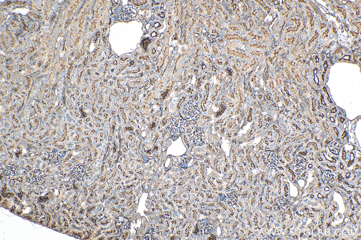 Immunohistochemistry (IHC) staining of mouse kidney tissue using Moesin Recombinant antibody (82009-1-RR)