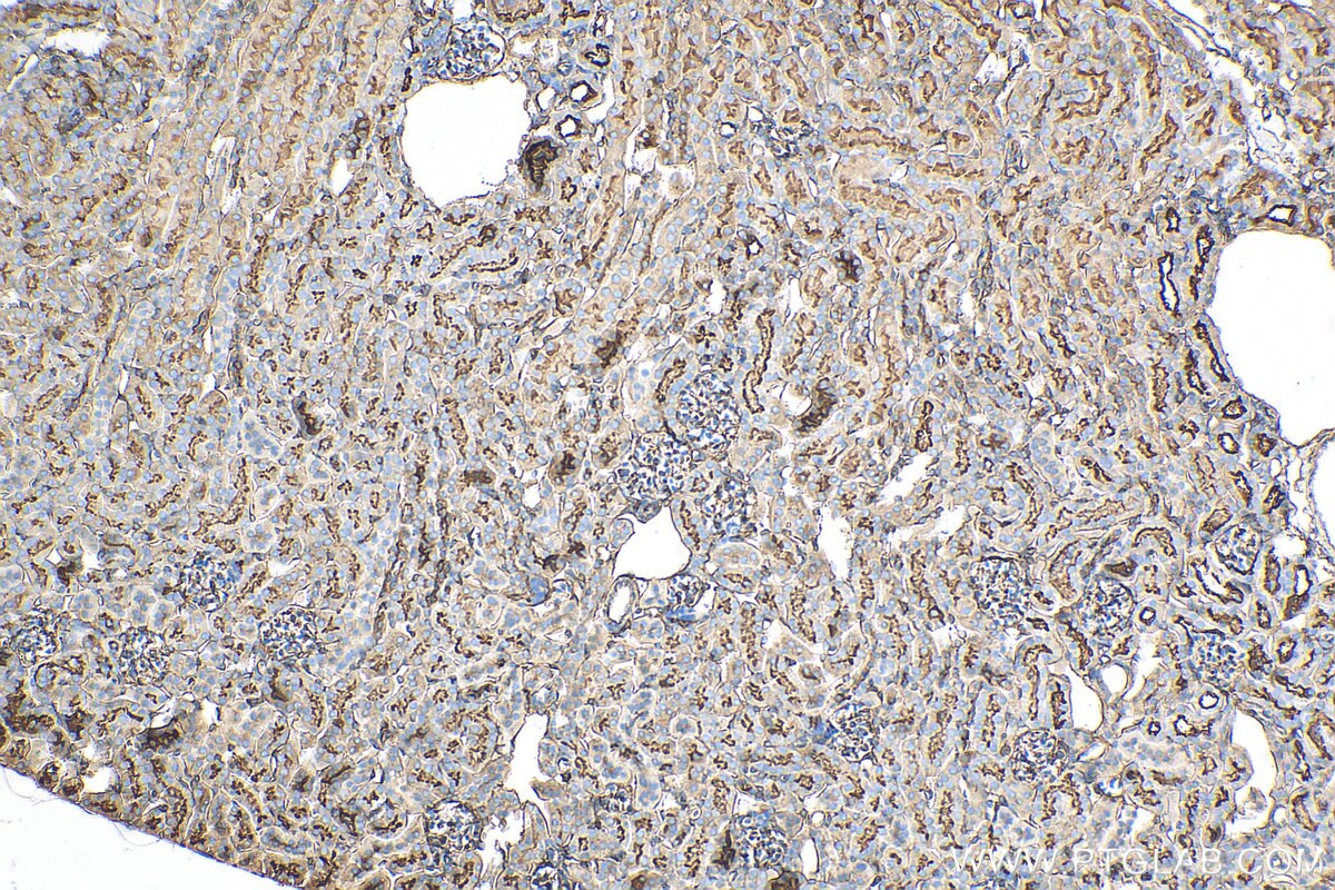 Immunohistochemistry (IHC) staining of mouse kidney tissue using Moesin Recombinant antibody (82009-1-RR)