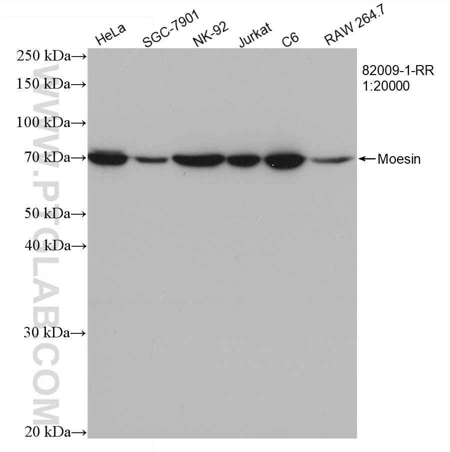 Western Blot (WB) analysis of various lysates using Moesin Recombinant antibody (82009-1-RR)