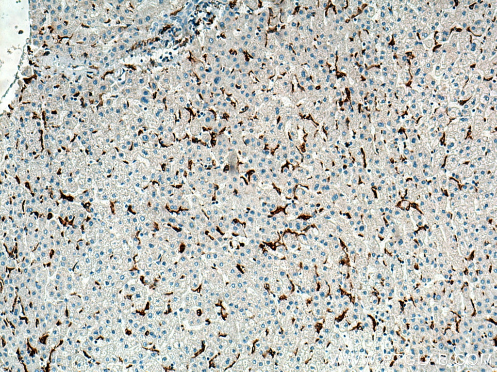 Immunohistochemistry (IHC) staining of human liver tissue using MSR1 Polyclonal antibody (17858-1-AP)