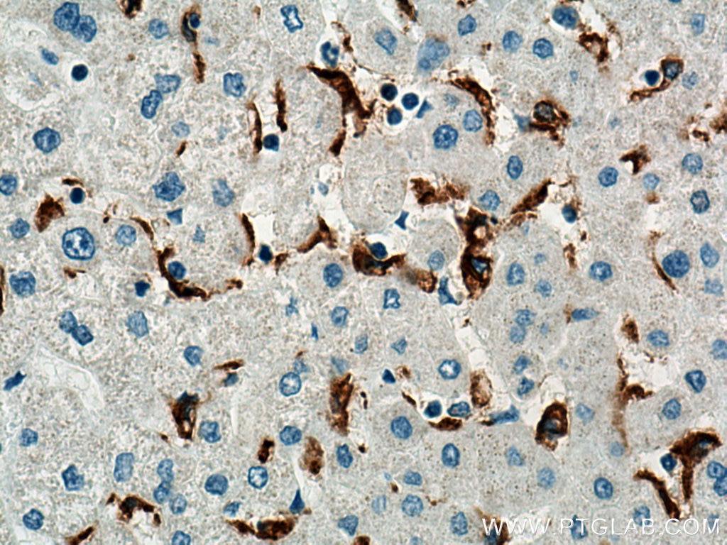 Immunohistochemistry (IHC) staining of human liver tissue using MSR1 Polyclonal antibody (17858-1-AP)
