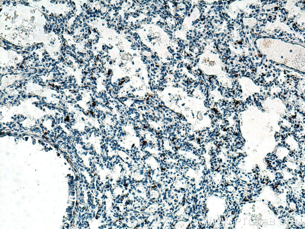 Immunohistochemistry (IHC) staining of human lung tissue using MSR1 Polyclonal antibody (17858-1-AP)