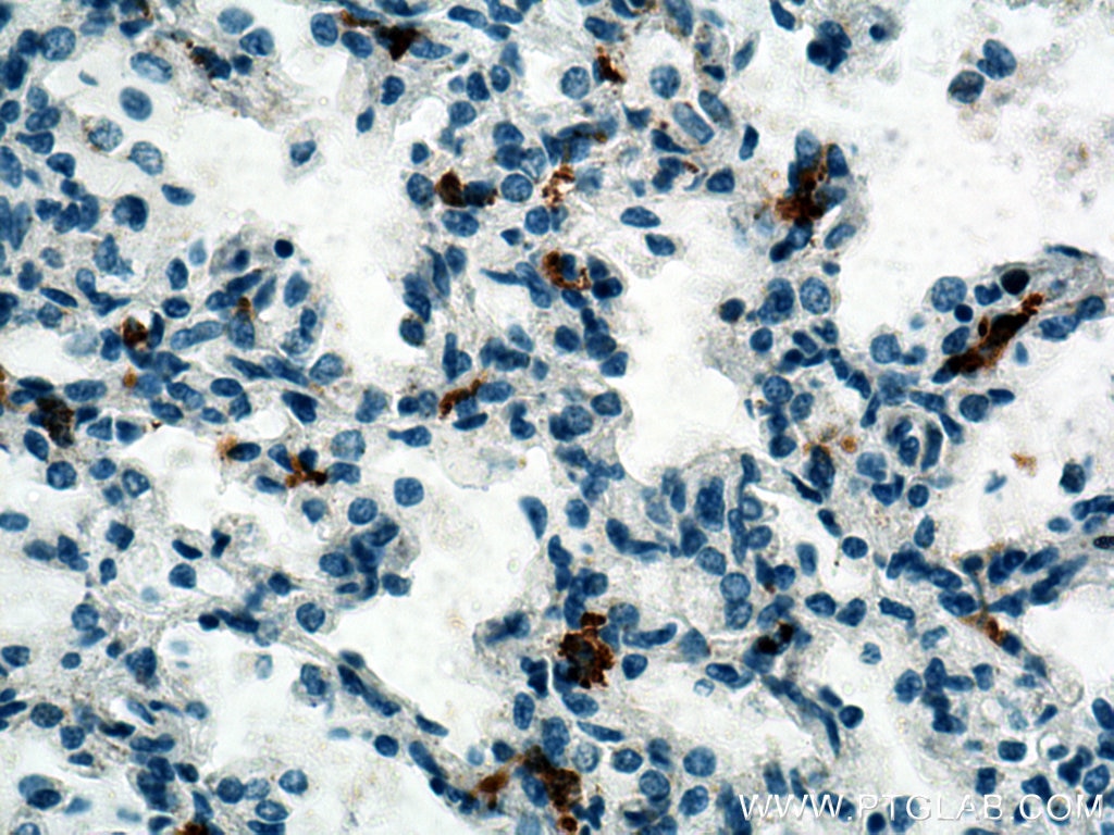 Immunohistochemistry (IHC) staining of human lung tissue using MSR1 Polyclonal antibody (17858-1-AP)