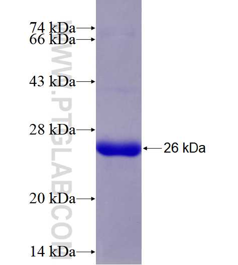 MSR1 fusion protein Ag28485 SDS-PAGE