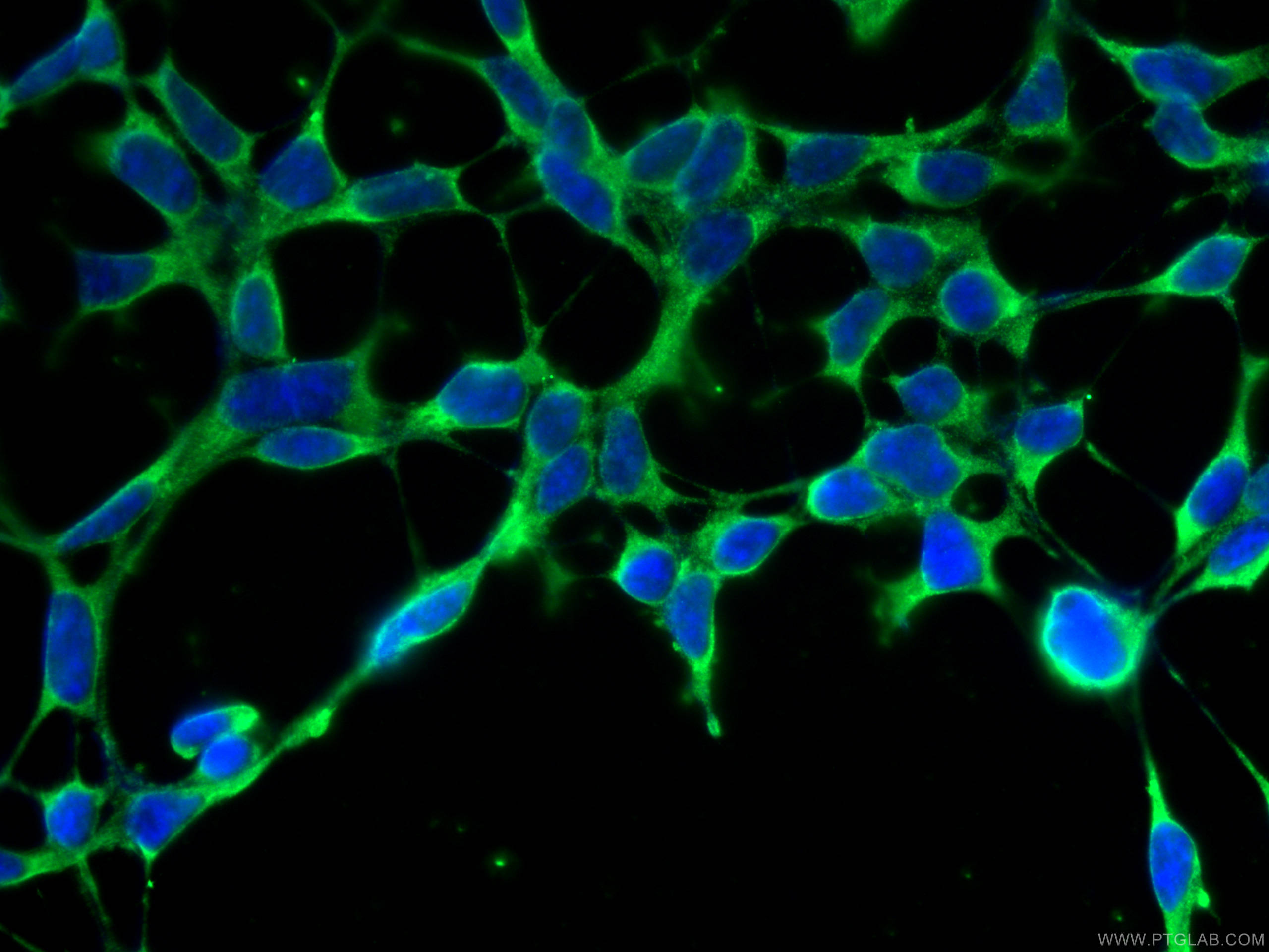 Immunofluorescence (IF) / fluorescent staining of HEK-293 cells using MSRA Polyclonal antibody (14547-1-AP)