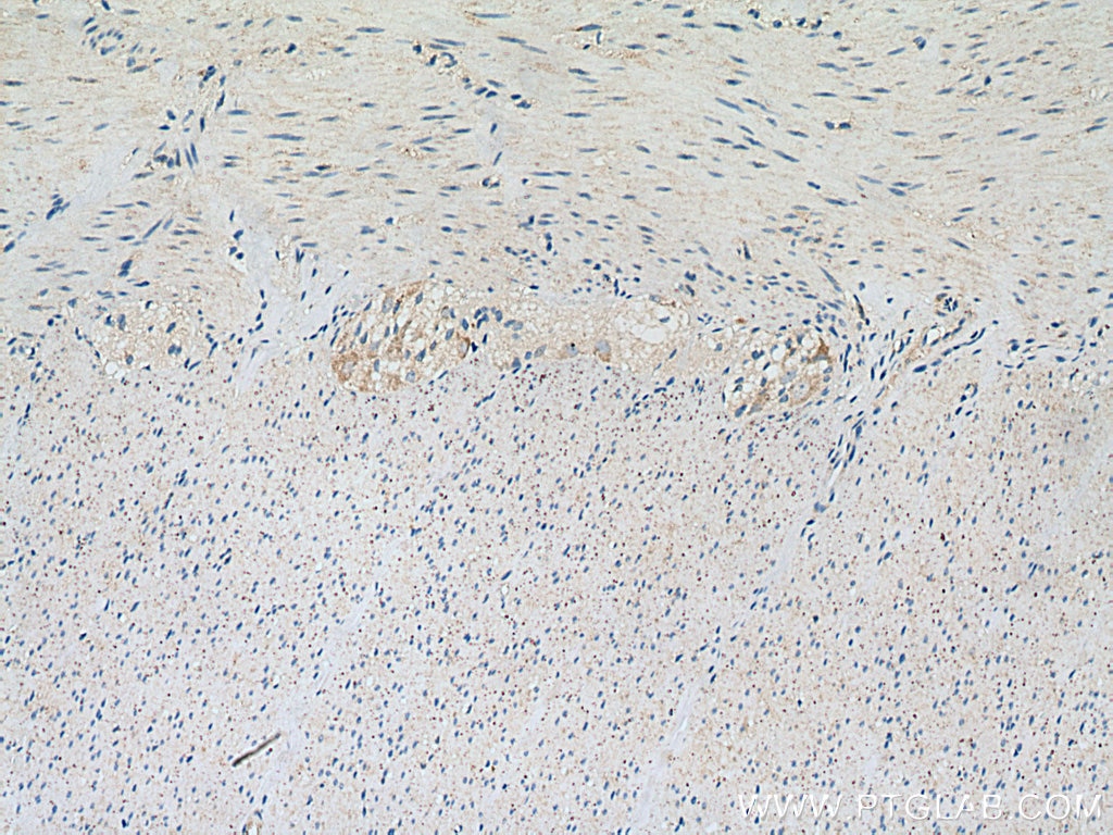 Immunohistochemistry (IHC) staining of human colon tissue using MSRA Polyclonal antibody (14547-1-AP)