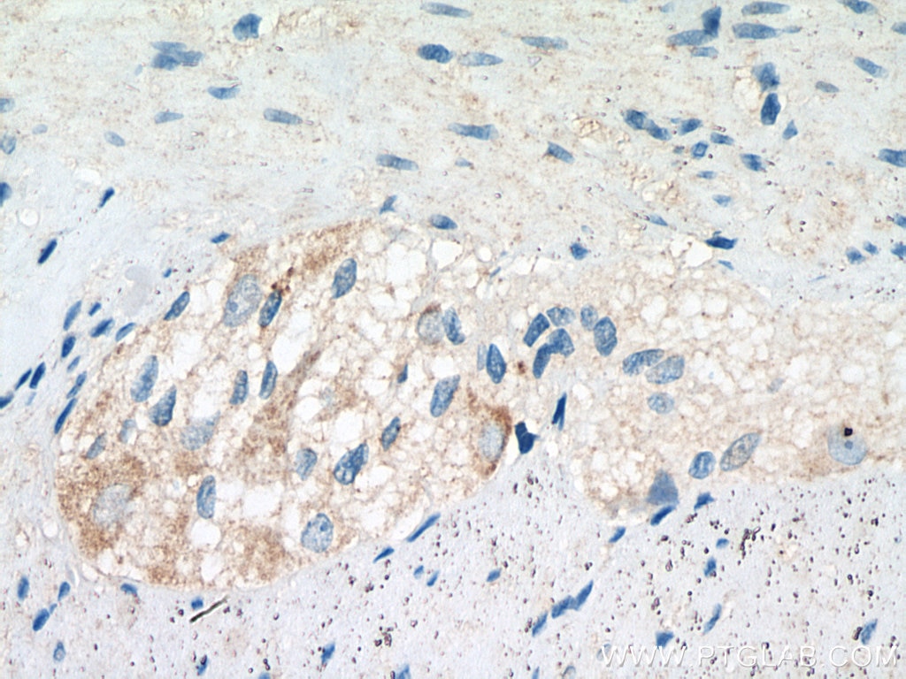 Immunohistochemistry (IHC) staining of human colon tissue using MSRA Polyclonal antibody (14547-1-AP)