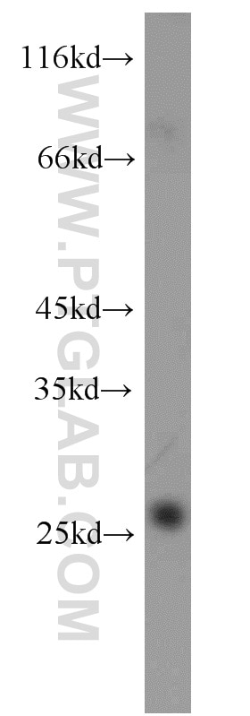 Western Blot (WB) analysis of human kidney tissue using MSRA Polyclonal antibody (14547-1-AP)