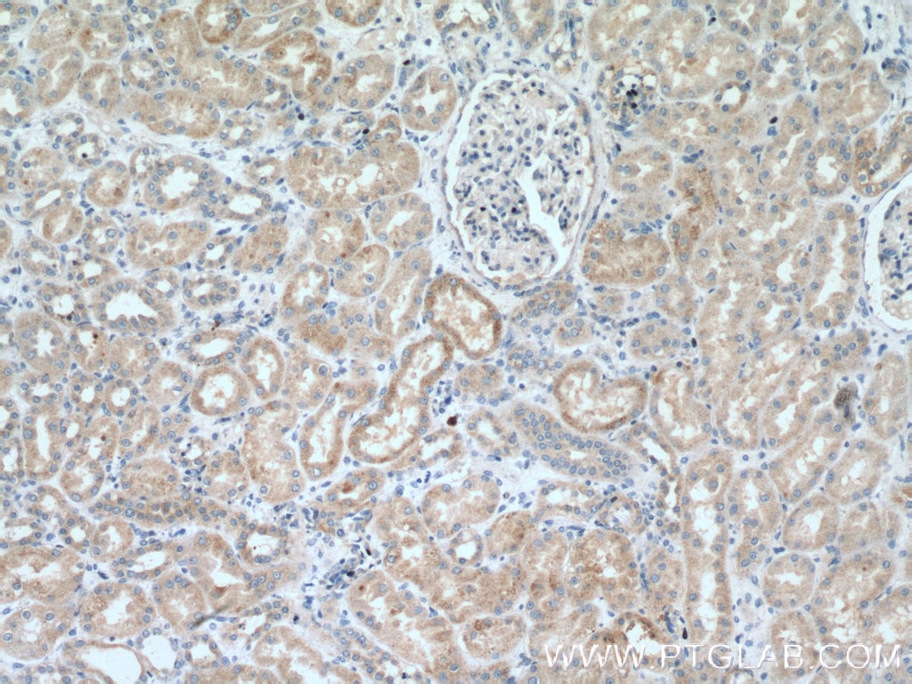 Immunohistochemistry (IHC) staining of human kidney tissue using MSRB2 Polyclonal antibody (17629-1-AP)
