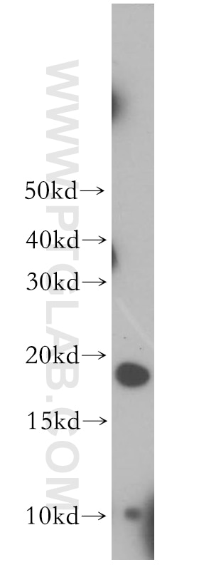 Western Blot (WB) analysis of human heart tissue using MSRB2 Polyclonal antibody (17629-1-AP)