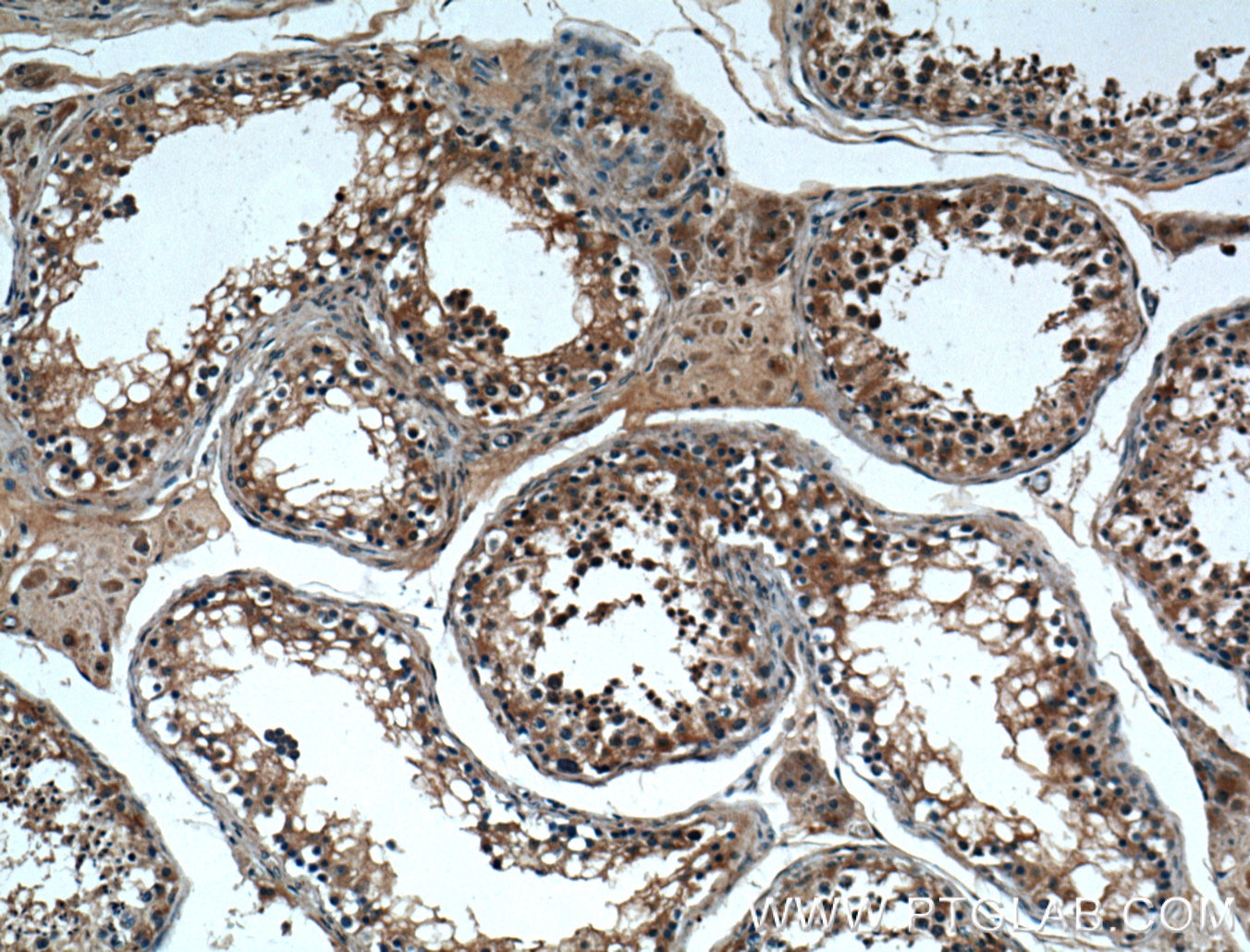 Immunohistochemistry (IHC) staining of human testis tissue using MSRB3 Polyclonal antibody (14251-1-AP)