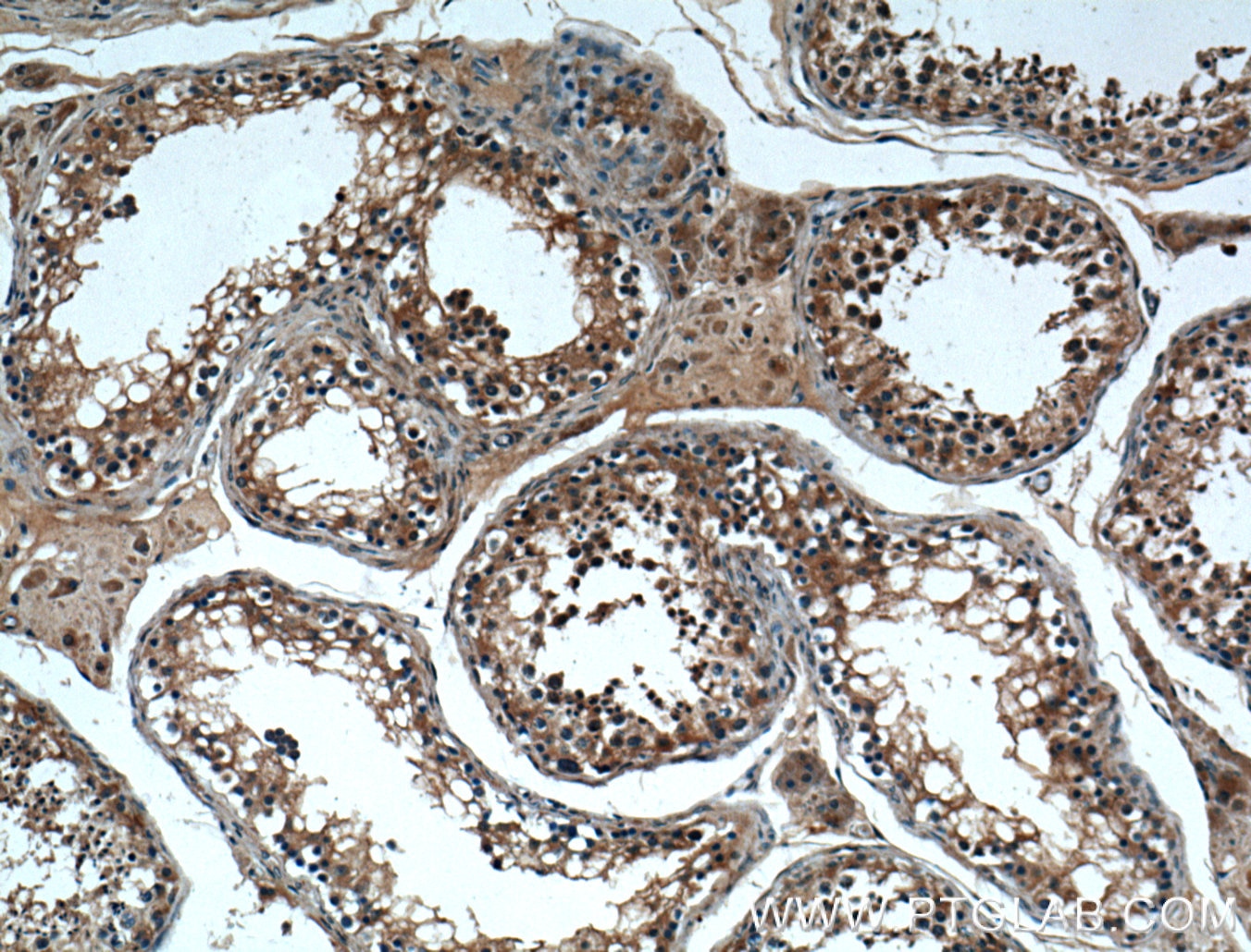 IHC staining of human testis using 14251-1-AP