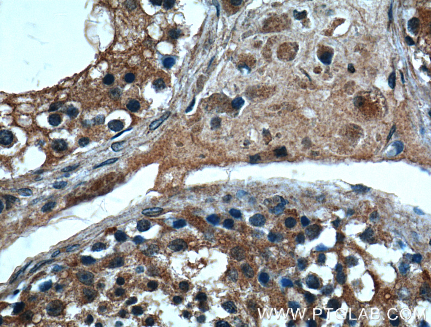 Immunohistochemistry (IHC) staining of human testis tissue using MSRB3 Polyclonal antibody (14251-1-AP)