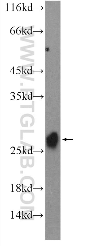 Western Blot (WB) analysis of mouse testis tissue using MSRB3 Polyclonal antibody (14251-1-AP)