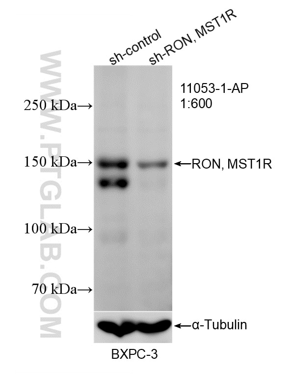 WB result of RON, MST1R antibody (11053-1-AP; 1:600; incubated at room temperature for 1.5 hours) with sh-Control and sh-RON, MST1R transfected BxPC-3 cells. Western Blot (WB) analysis of BxPC-3 cells using RON, MST1R Polyclonal antibody (11053-1-AP)