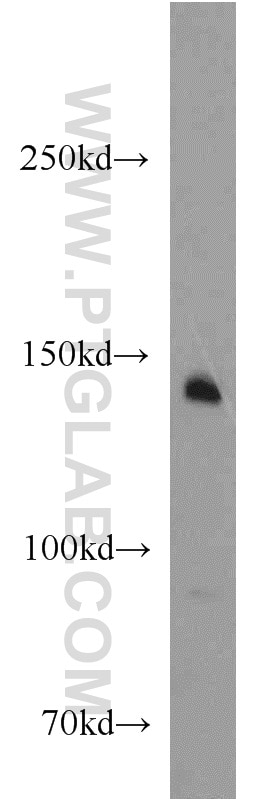 Western Blot (WB) analysis of mouse lung tissue using RON, MST1R Polyclonal antibody (11053-1-AP)