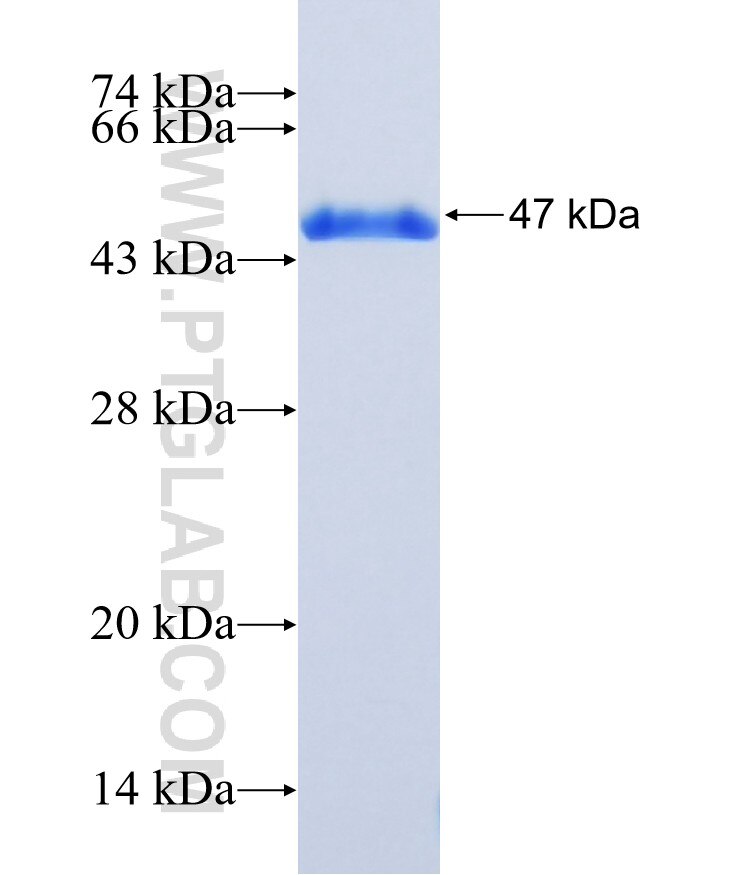 MST4 fusion protein Ag1302 SDS-PAGE