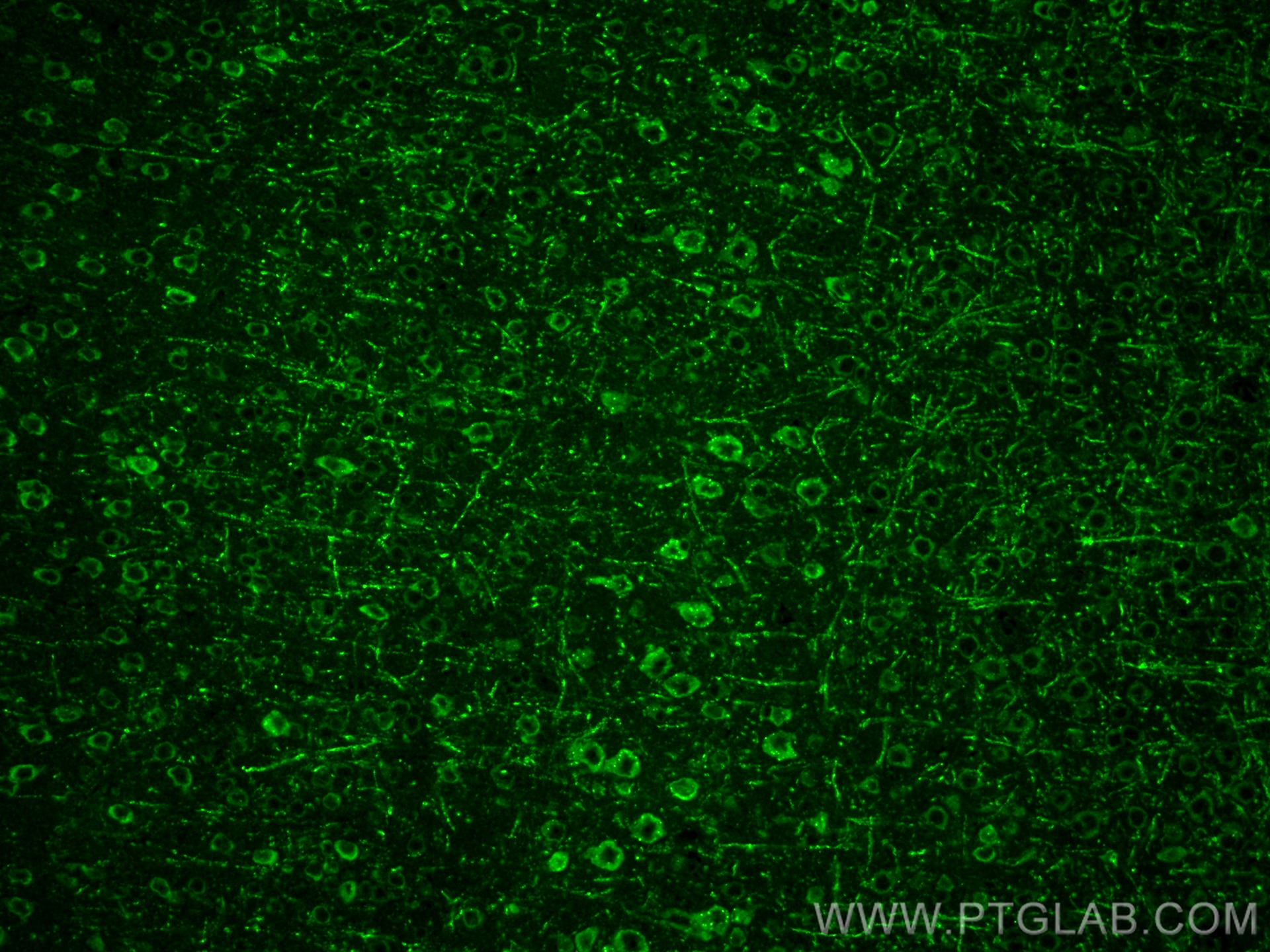 Immunofluorescence (IF) / fluorescent staining of mouse brain tissue using GDF8/Myostatin Polyclonal antibody (19142-1-AP)