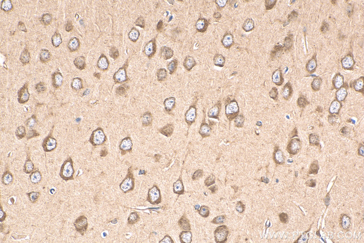 Immunohistochemistry (IHC) staining of mouse brain tissue using GDF8/Myostatin Polyclonal antibody (19142-1-AP)