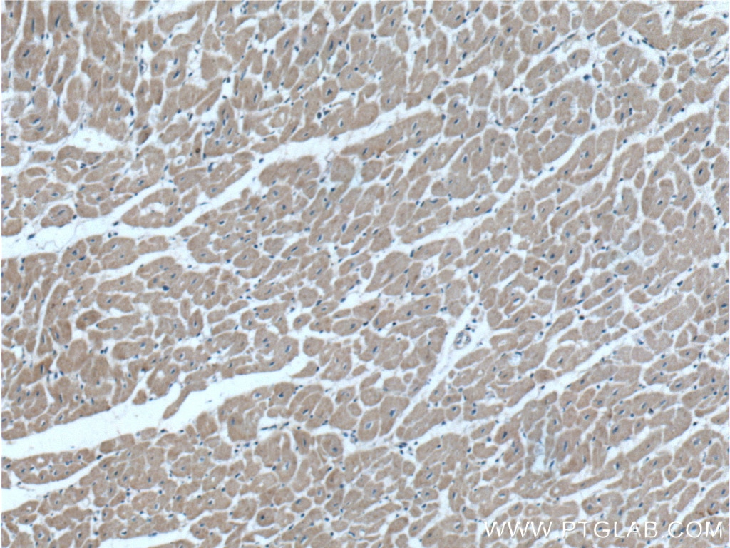 Immunohistochemistry (IHC) staining of human heart tissue using GDF8/Myostatin Polyclonal antibody (19142-1-AP)
