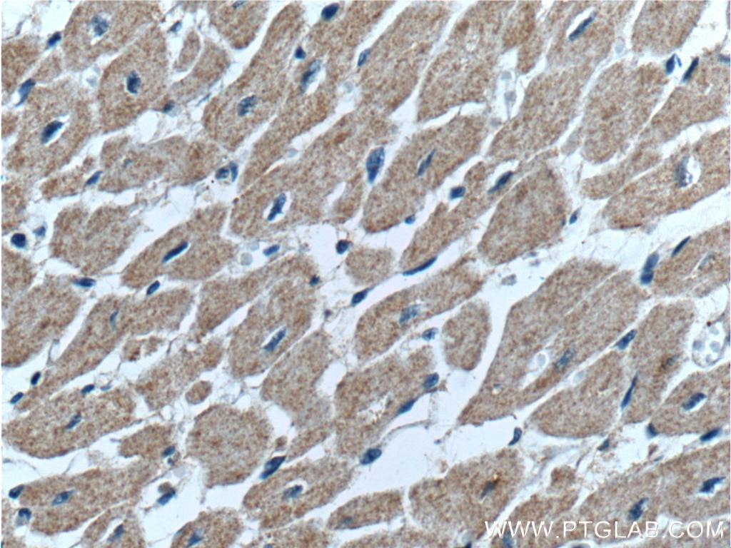 Immunohistochemistry (IHC) staining of human heart tissue using GDF8/Myostatin Polyclonal antibody (19142-1-AP)