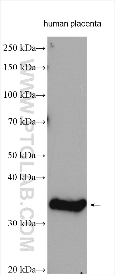 Western Blot (WB) analysis of various lysates using GDF8/Myostatin Polyclonal antibody (19142-1-AP)