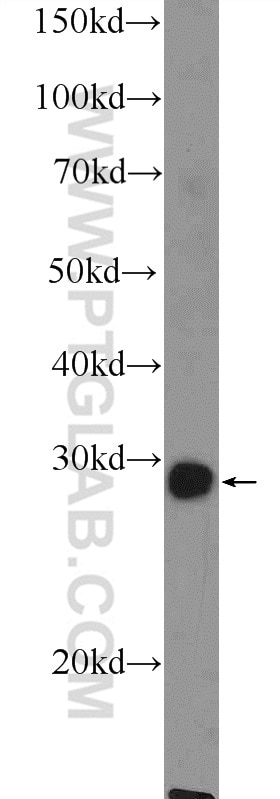 Western Blot (WB) analysis of mouse skeletal muscle tissue using MSX1 Polyclonal antibody (17678-1-AP)