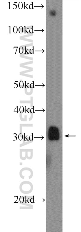 Western Blot (WB) analysis of mouse skeletal muscle tissue using MSX1 Polyclonal antibody (17678-1-AP)