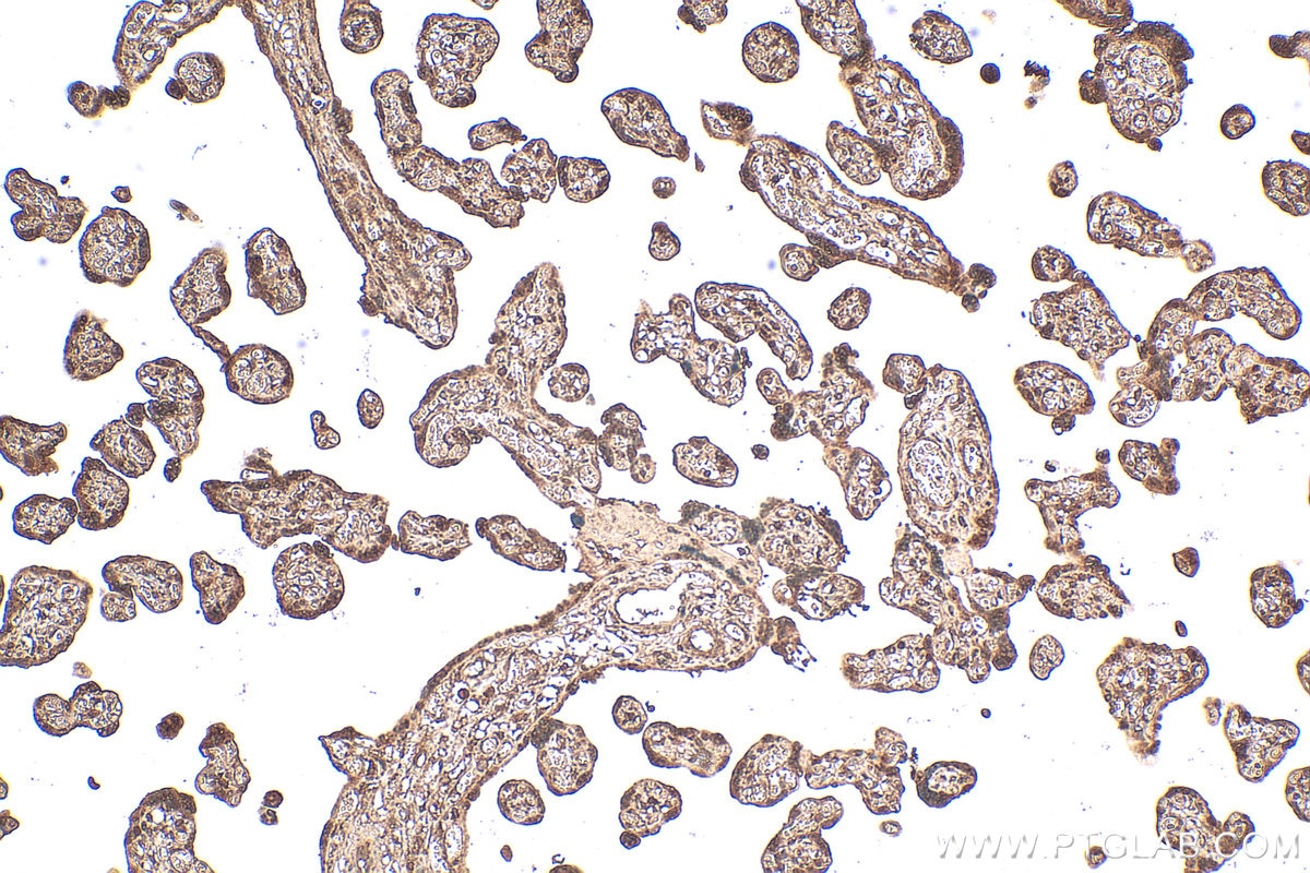 Immunohistochemical analysis of paraffin-embedded human placenta tissue slide using 68550-1-Ig (MSX2 antibody) at dilution of 1:200 (under 10x lens). Heat mediated antigen retrieval with Tris-EDTA buffer (pH 9.0). Immunohistochemistry (IHC) staining of human placenta tissue using MSX2 Monoclonal antibody (68550-1-Ig)