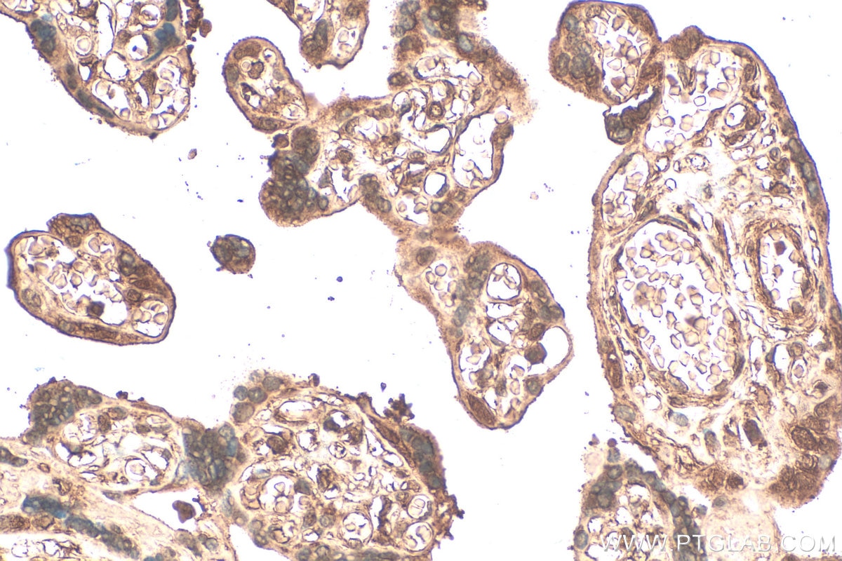 Immunohistochemical analysis of paraffin-embedded human placenta tissue slide using 68550-1-Ig (MSX2 antibody) at dilution of 1:200 (under 40x lens). Heat mediated antigen retrieval with Tris-EDTA buffer (pH 9.0). Immunohistochemistry (IHC) staining of human placenta tissue using MSX2 Monoclonal antibody (68550-1-Ig)
