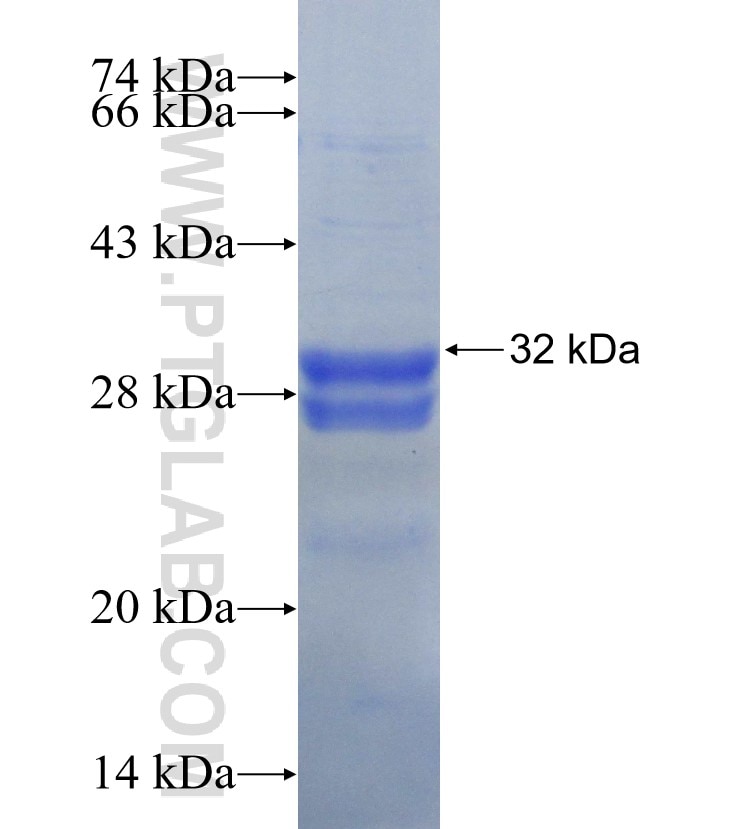 MT-ATP8 fusion protein Ag30024 SDS-PAGE