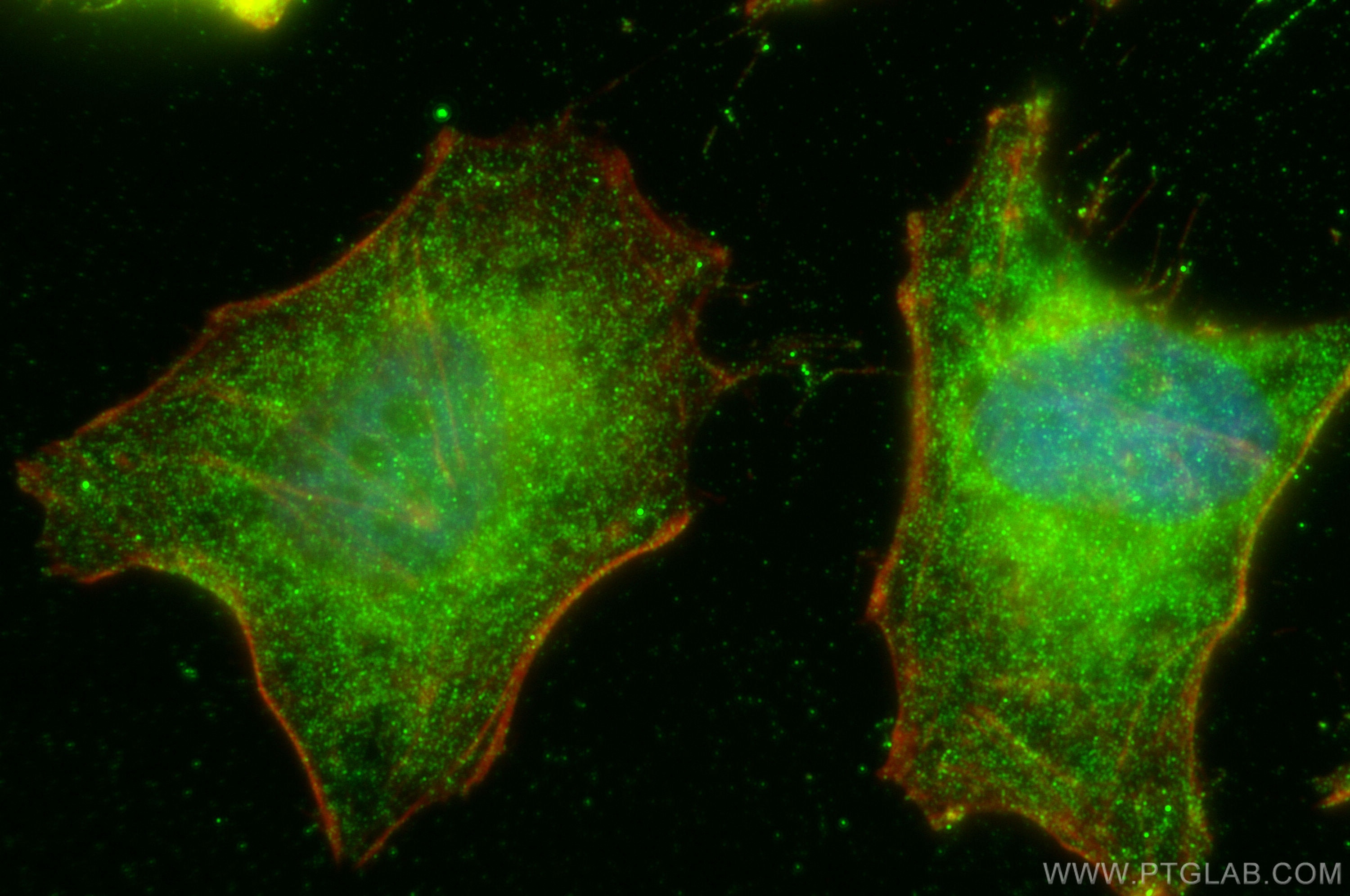 Immunofluorescence (IF) / fluorescent staining of HeLa cells using MT1A Polyclonal antibody (27115-1-AP)