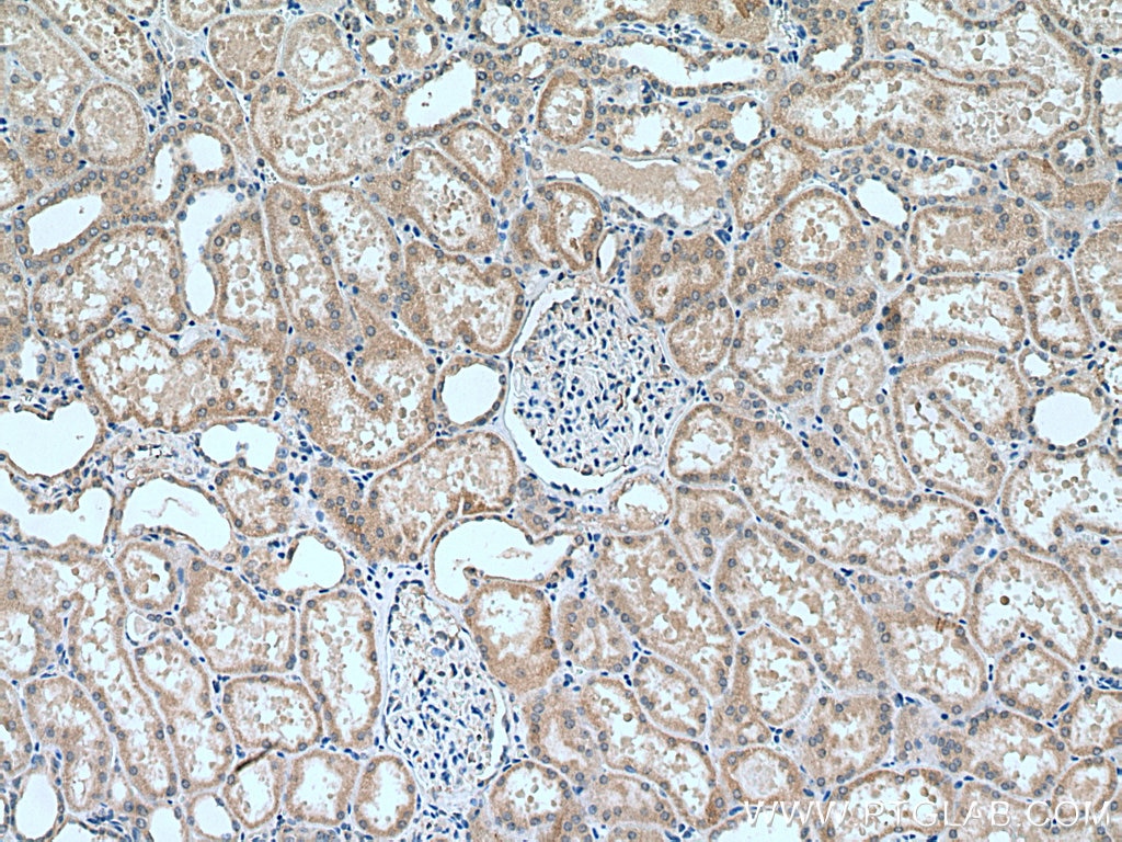 IHC staining of human kidney using 27115-1-AP