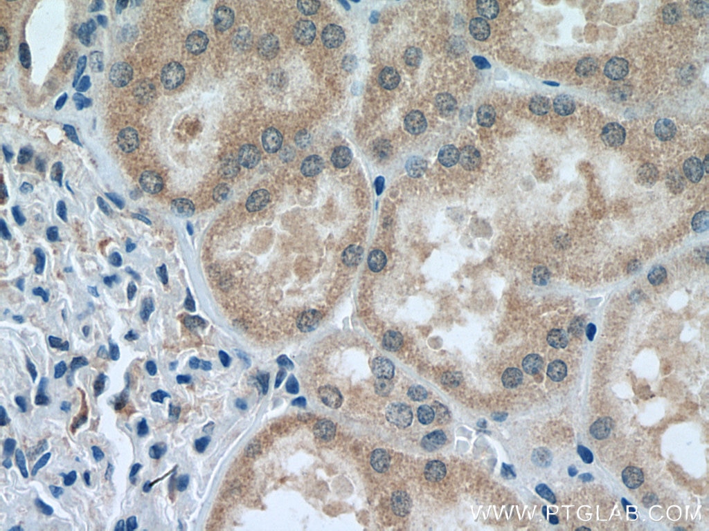Immunohistochemistry (IHC) staining of human kidney tissue using MT1A Polyclonal antibody (27115-1-AP)