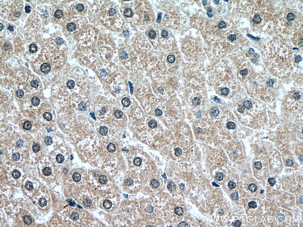 Immunohistochemistry (IHC) staining of human liver tissue using MT1A Polyclonal antibody (27115-1-AP)