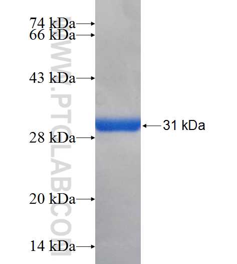 MT1A fusion protein Ag25747 SDS-PAGE
