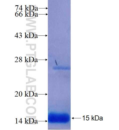 MT1A fusion protein Ag25752 SDS-PAGE
