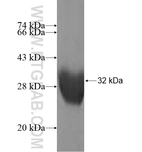 MT1A fusion protein Ag10135 SDS-PAGE