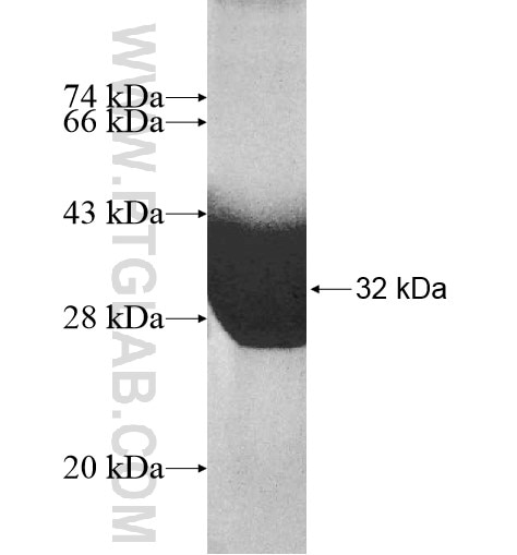 MT1E fusion protein Ag10440 SDS-PAGE