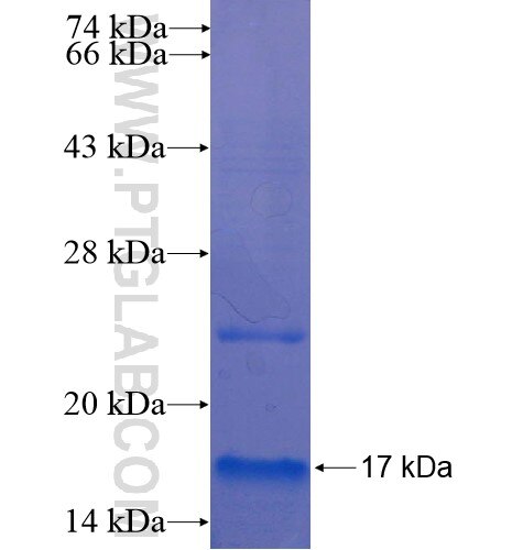 MT1E fusion protein Ag13303 SDS-PAGE MT1E fusion protein Ag13303 SDS-PAGE
