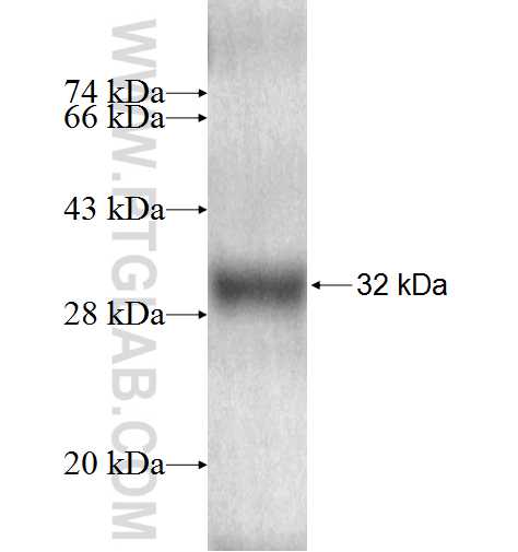 MT1F fusion protein Ag9766 SDS-PAGE