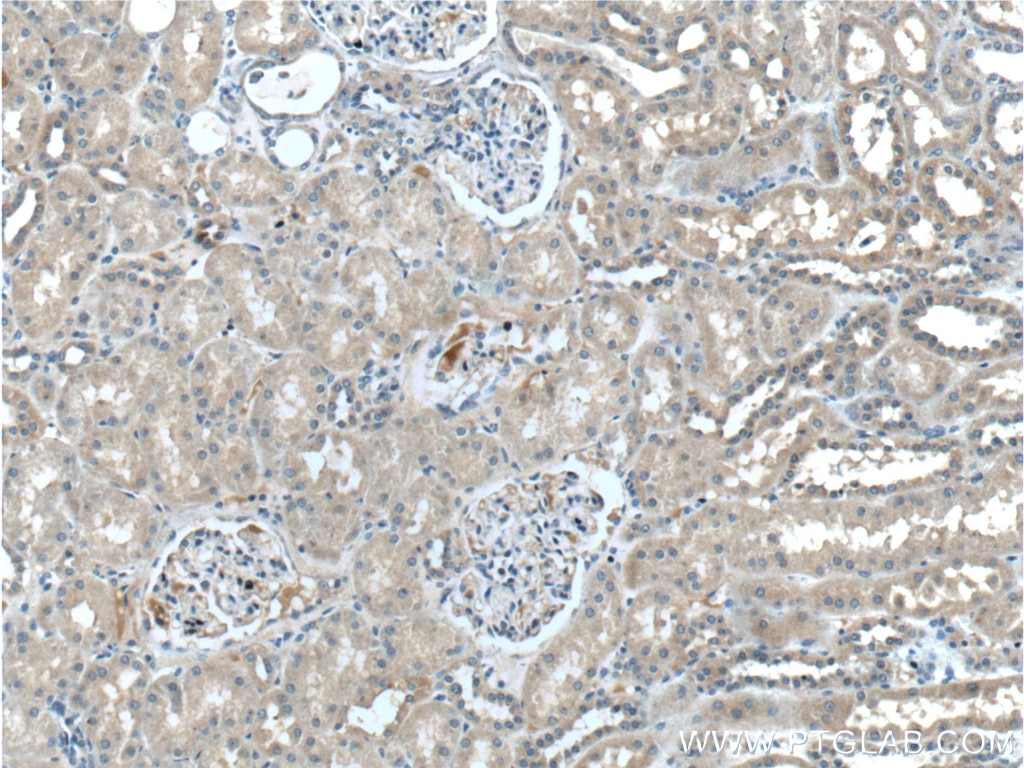 Immunohistochemistry (IHC) staining of human kidney tissue using MT1M Polyclonal antibody (17281-1-AP)