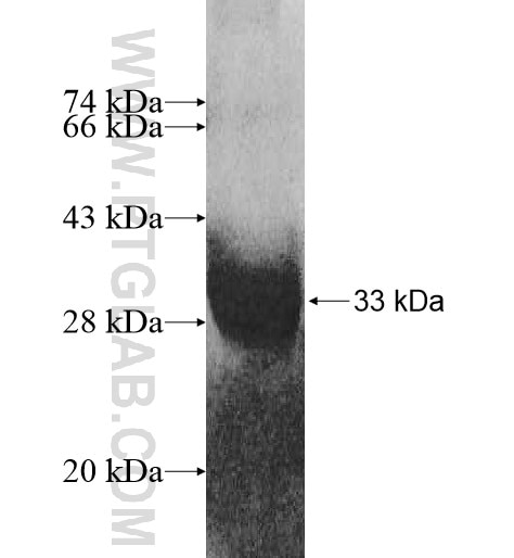 MT1M fusion protein Ag11048 SDS-PAGE