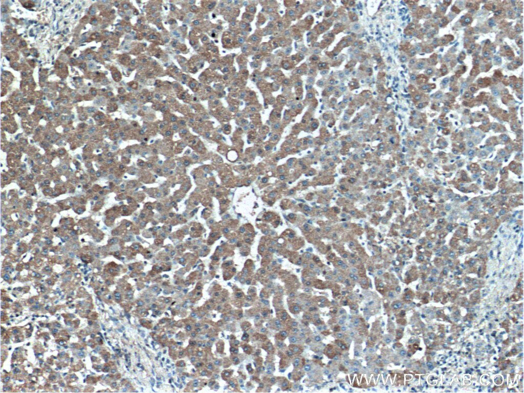 Immunohistochemistry (IHC) staining of human liver tissue using MT1X Polyclonal antibody (17172-1-AP)