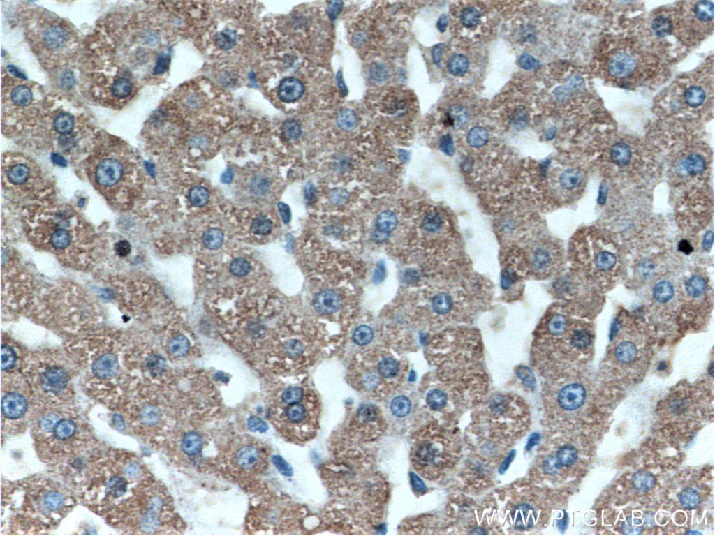Immunohistochemistry (IHC) staining of human liver tissue using MT1X Polyclonal antibody (17172-1-AP)